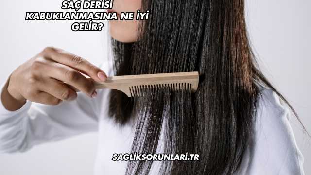 Saç Derisi Kabuklanmasına Ne İyi Gelir?
