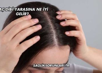 Saç Dibi Yarasına Ne İyi Gelir?