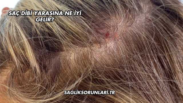 Saç Dibi Yarasına Ne İyi Gelir?