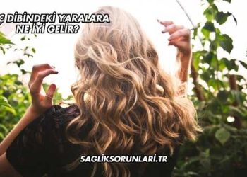 Saç Dibindeki Yaralara Ne İyi Gelir?