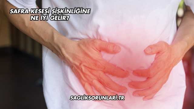 Safra Kesesi Şişkinliğine Ne İyi Gelir?