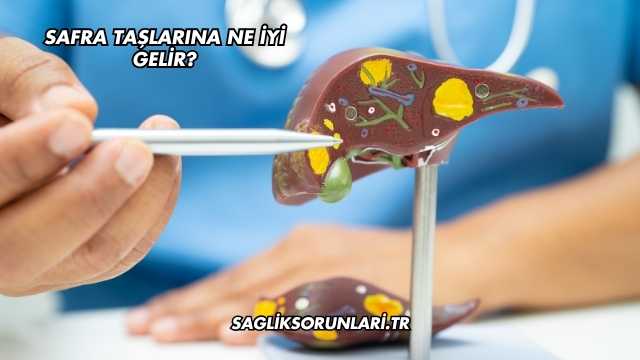 Safra Taşlarına Ne İyi Gelir?