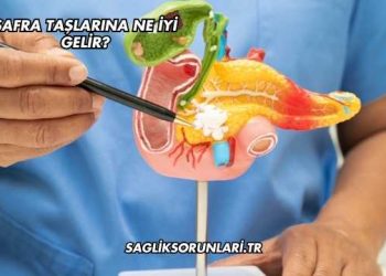 Safra Taşlarına Ne İyi Gelir?