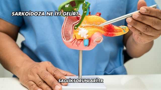 Sarkoidoza Ne İyi Gelir?