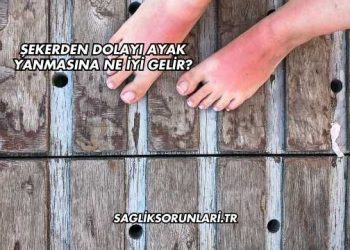 Şekerden Dolayı Ayak Yanmasına Ne İyi Gelir?
