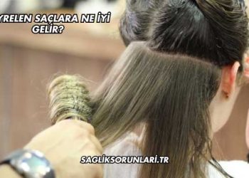Seyrelen Saçlara Ne İyi Gelir?