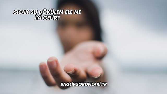 Sıcak Su Dökülen Ele Ne İyi Gelir?