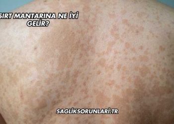 Sırt Mantarına Ne İyi Gelir?