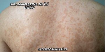 Sırt Mantarına Ne İyi Gelir?