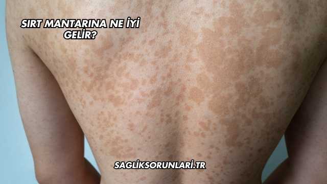 Sırt Mantarına Ne İyi Gelir?