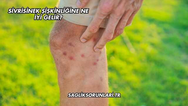 Sivrisinek Şişkinliğine Ne İyi Gelir?
