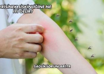 Sivrisinek Şişkinliğine Ne İyi Gelir?