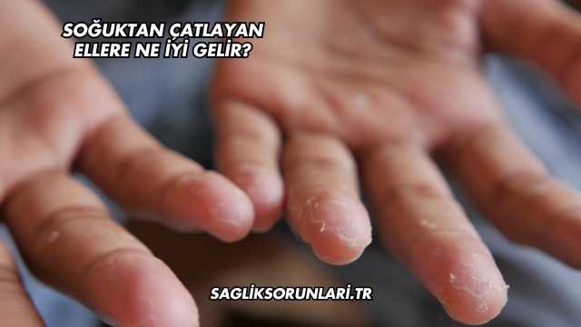 Soğuktan Çatlayan Ellere Ne İyi Gelir?