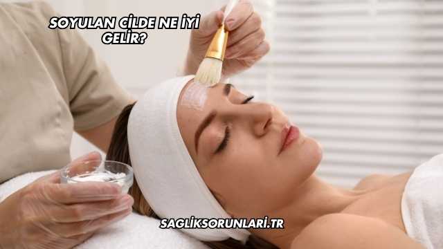 Soyulan Cilde Ne İyi Gelir?