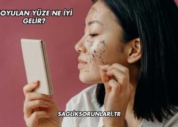 Soyulan Yüze Ne İyi Gelir?
