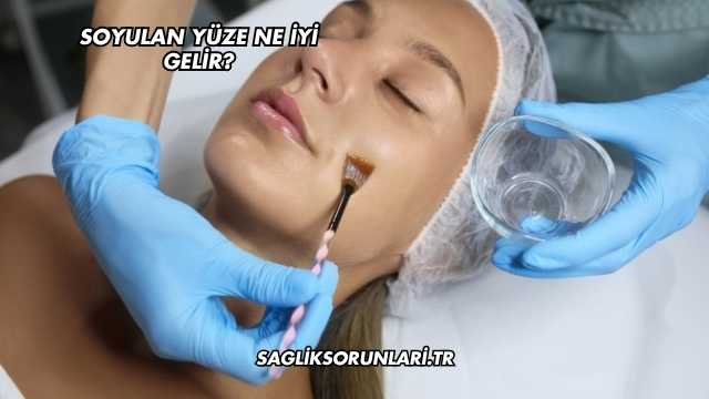 Soyulan Yüze Ne İyi Gelir?