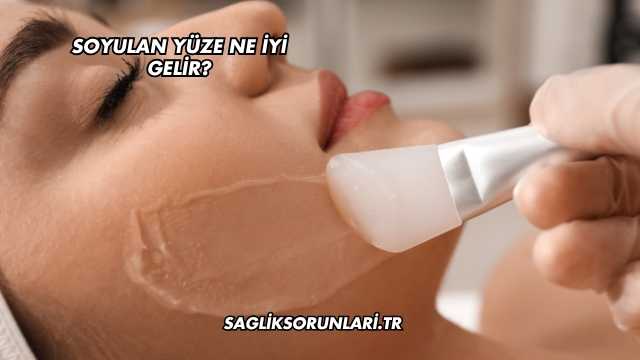 Soyulan Yüze Ne İyi Gelir?