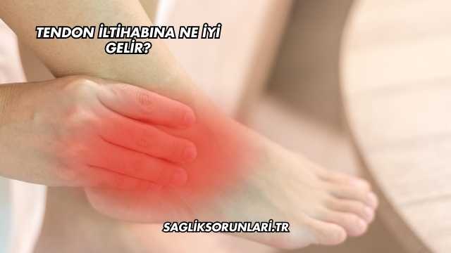 Tendon İltihabına Ne İyi Gelir?