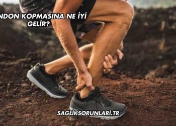 Tendon Kopmasına Ne İyi Gelir?