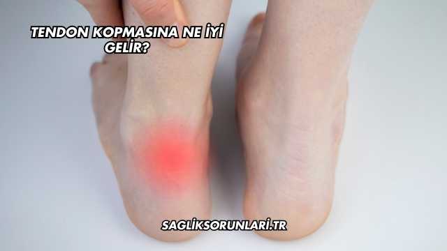 Tendon Kopmasına Ne İyi Gelir?