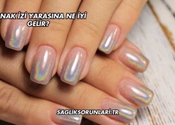 Tırnak İzi Yarasına Ne İyi Gelir?