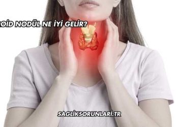 Tiroid Nodül Ne İyi Gelir?