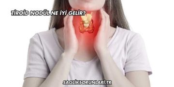 Tiroid Nodül Ne İyi Gelir?