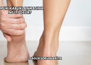 Topuk Kabuklanmasına Ne İyi Gelir?
