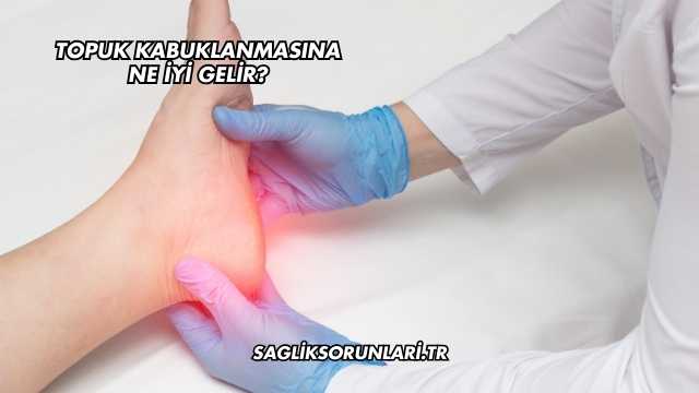 Topuk Kabuklanmasına Ne İyi Gelir?
