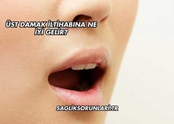 Üst Damak İltihabına Ne İyi Gelir?