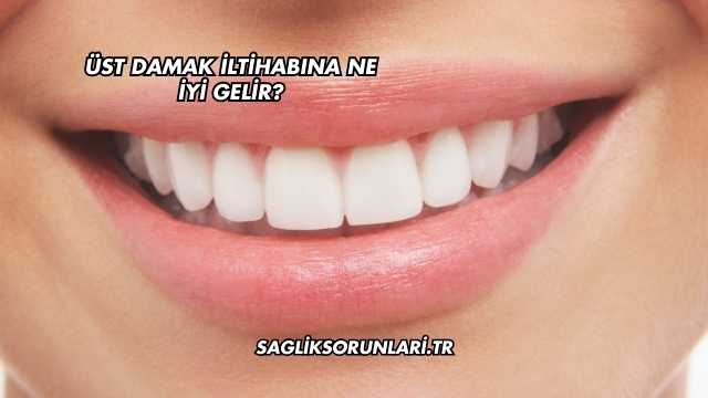 Üst Damak İltihabına Ne İyi Gelir?