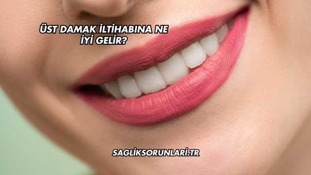 Üst Damak İltihabına Ne İyi Gelir?