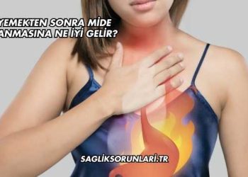 Yemekten Sonra Mide Yanmasına Ne İyi Gelir?