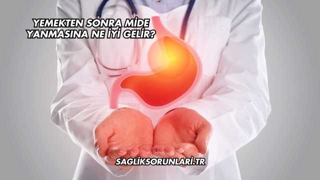Yemekten Sonra Mide Yanmasına Ne İyi Gelir?