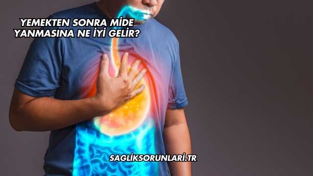 Yemekten Sonra Mide Yanmasına Ne İyi Gelir?