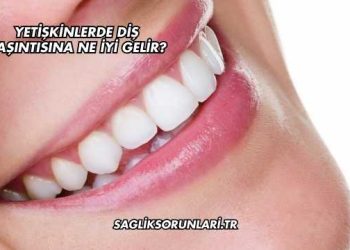 Yetişkinlerde Diş Kaşıntısına Ne İyi Gelir?