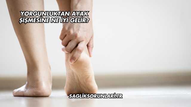 Yorgunluktan Ayak Şişmesine Ne İyi Gelir?