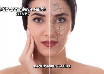 Yüz Çatlağına Ne İyi Gelir?