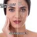 Yüz Çatlağına Ne İyi Gelir?