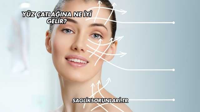 Yüz Çatlağına Ne İyi Gelir?