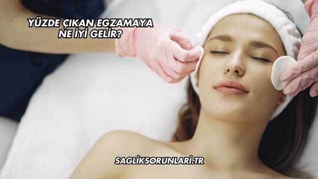Yüzde Çıkan Egzamaya Ne İyi Gelir?