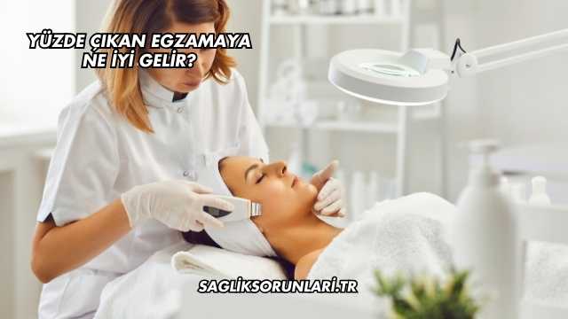 Yüzde Çıkan Egzamaya Ne İyi Gelir?