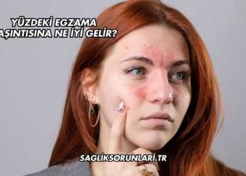 Yüzdeki Egzama Kaşıntısına Ne İyi Gelir?
