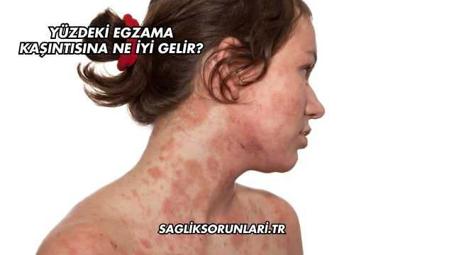 Yüzdeki Egzama Kaşıntısına Ne İyi Gelir?