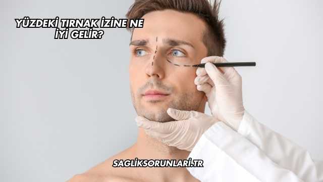 Yüzdeki Tırnak İzine Ne İyi Gelir?