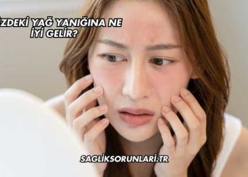 Yüzdeki Yağ Yanığına Ne İyi Gelir?