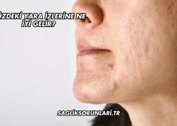 Yüzdeki Yara İzlerine Ne İyi Gelir?