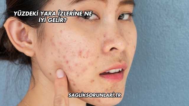 Yüzdeki Yara İzlerine Ne İyi Gelir?