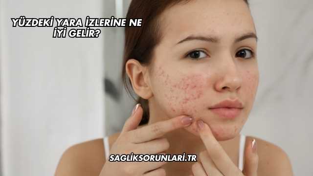 Yüzdeki Yara İzlerine Ne İyi Gelir?