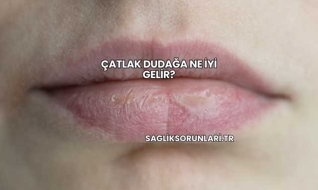 Çatlak Dudağa Ne İyi Gelir?